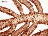 4 – Ramificazioni laterali nella porzione subapicale del tallo